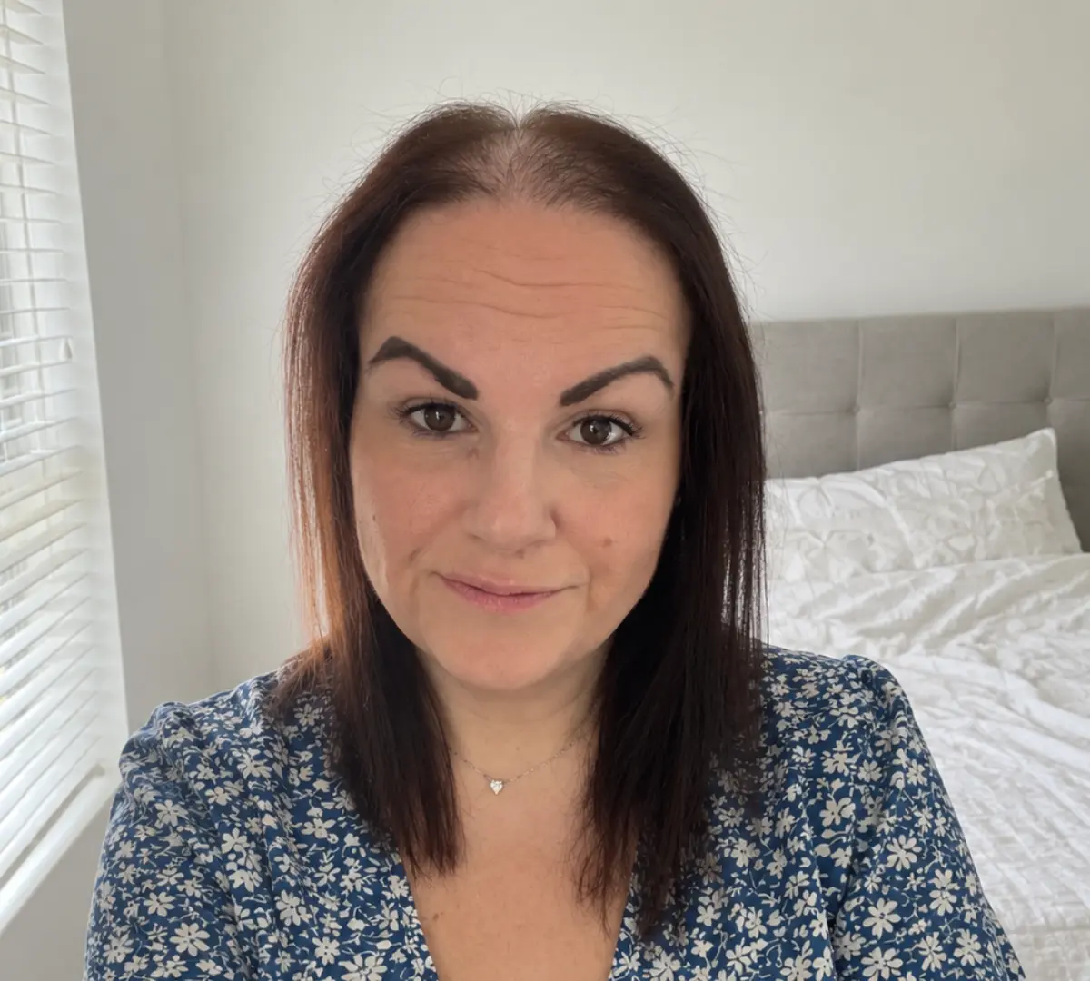 Chloe T. before using Pepthair