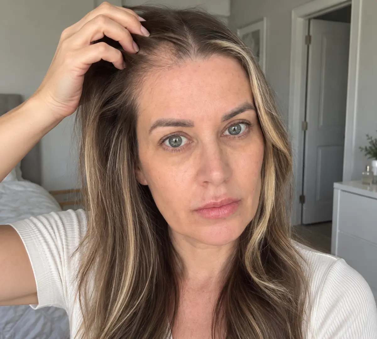 Megan R. before using Pepthair